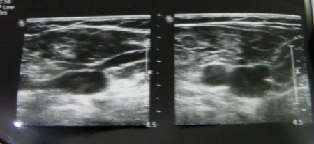 black and white blurry images